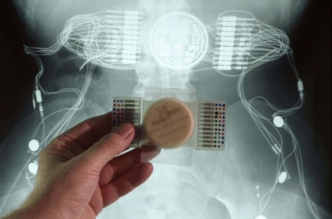 Inteligjenca Artificiale po kalon çdo limit, ka filluar të lexojë manmachine e1557241843386 1089x720