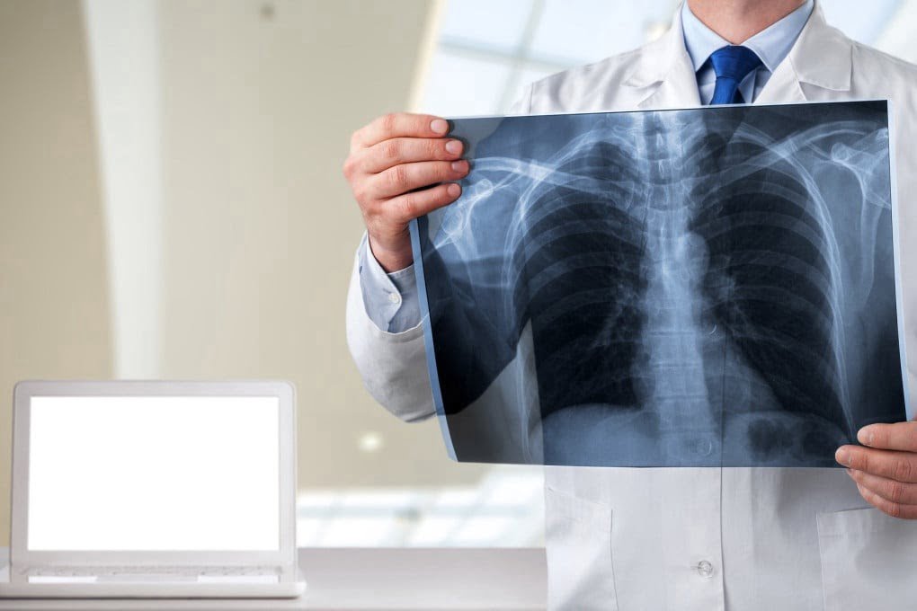 Inteligjenca artificiale hamendëson moshën tonë nga një rreze X – Pse është problem nëse dukemi më të vjetër?