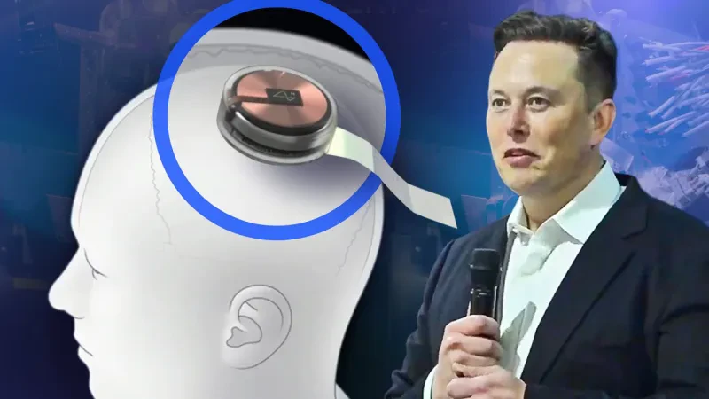 Musk premton të shpëtojë njerëzimin! – Brenda 6 muajsh një çip do të instalohet në trurin e njeriut!