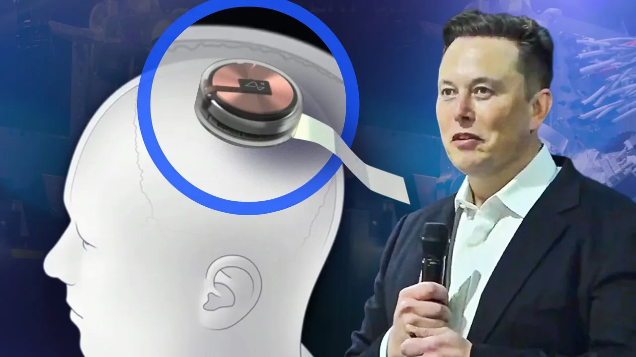Musk premton të shpëtojë njerëzimin! – Brenda 6 muajsh një çip do të instalohet në trurin e njeriut!