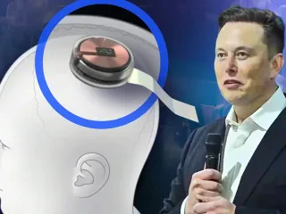 Musk premton të shpëtojë njerëzimin! – Brenda 6 muajsh një çip do të instalohet në trurin e njeriut!