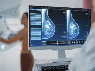 breast cancer 2