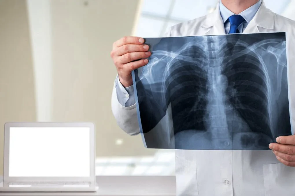 Inteligjenca artificiale hamendëson moshën tonë nga një rreze X – Pse është problem nëse dukemi më të vjetër?