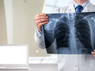 Inteligjenca artificiale hamendëson moshën tonë nga një rreze X – Pse është problem nëse dukemi më të vjetër?